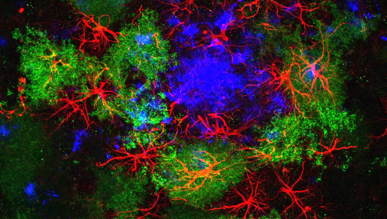e star-shaped astrocytes shown in red surround an amyloid plaque (blue) in a mouse's brain